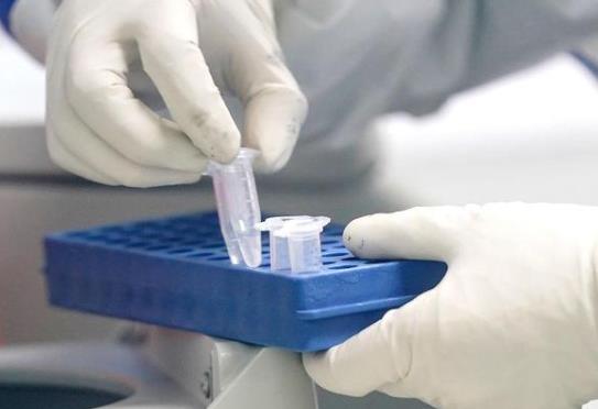 核酸檢測是住院前做還是住院后做?核酸檢測飯前做還是飯后做