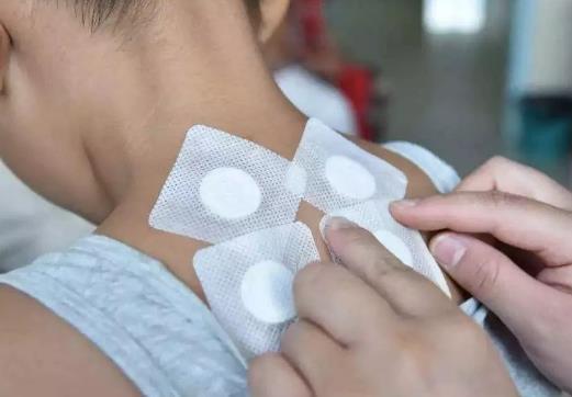 三伏貼沒到日子能貼嗎?三伏貼必須是現調的嗎?