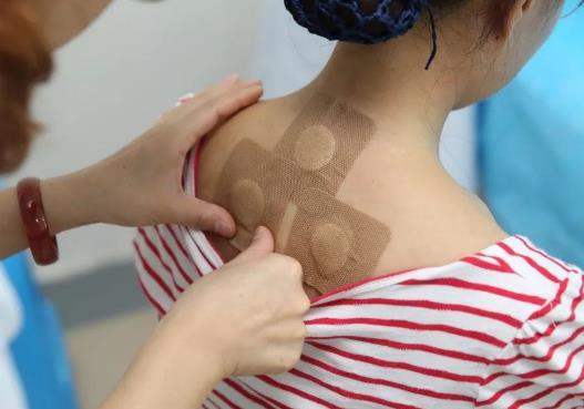 貼完三伏貼的第二天能同房嗎?三伏貼和艾灸能一起做嗎