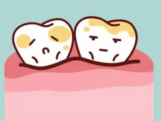 得了牙結石不想洗牙有別的方法嗎?洗了牙牙結石還會再有嗎