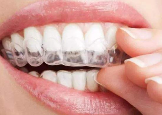 牙套戴久了真牙會爛嗎?戴牙套一邊疼一邊不疼可以吃飯嗎