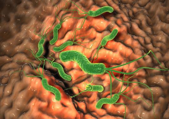 吃什么食物容易感染幽門螺桿菌?幽門螺桿菌舌吻幾次會被傳染