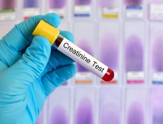 尿酸高的危害性有多大?體檢尿酸偏高怎么預防痛風