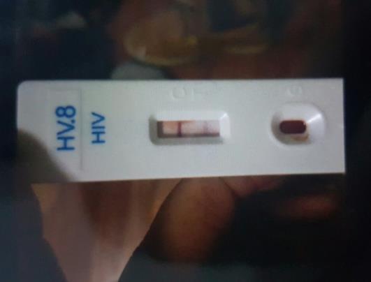 hiv試紙藥店沒賣怎么辦?艾滋試紙一分鐘就陰了會轉陽嗎