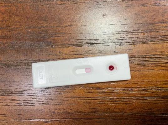 hiv試紙檢測(cè)準(zhǔn)確嗎?hiv試紙血量少會(huì)怎樣