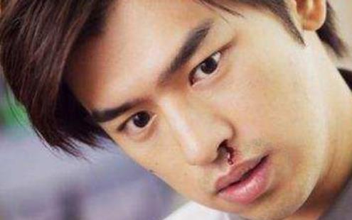 什么疾病會導致經常流鼻血 天氣干燥流鼻血怎么辦