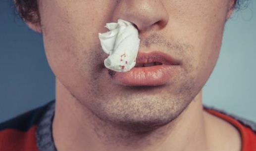 什么疾病會導致經常流鼻血 天氣干燥流鼻血怎么辦