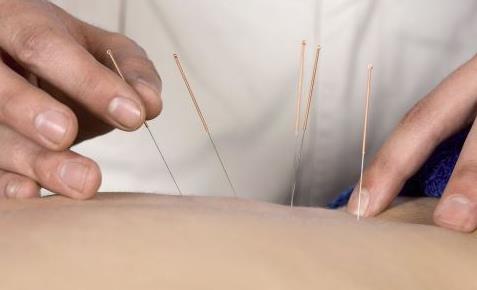 腰酸背痛的話該怎么緩解 腰酸背痛適合刮痧嗎