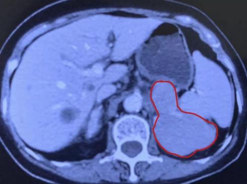 廣州復大腫瘤醫院評價好嗎 診療服務評價有保障