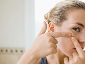 臉上長痘痘是什么原因?怎樣預防青春痘