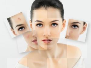 美白祛斑誤區:愛美女性必知的祛斑四誤區