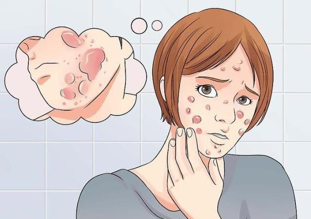 積雪苷霜軟膏:治的不僅僅是痘痘 也是療愈心靈的良藥