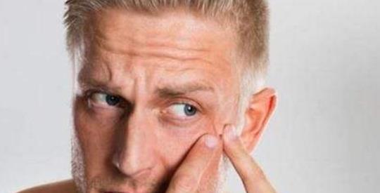 男生在青春期時長青春痘很常見 這些日常護(hù)膚要做好