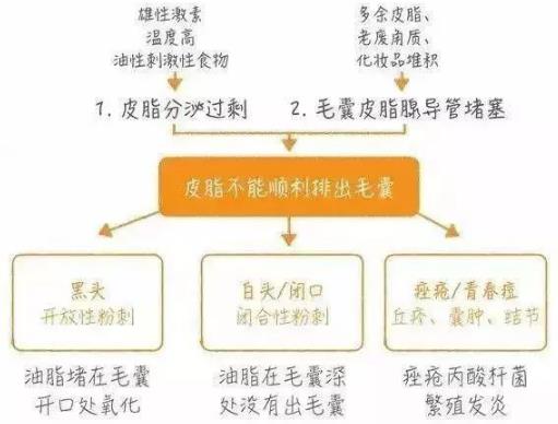 北京伊美爾幸福醫院:閉口粉刺會自己慢慢消失嗎?
