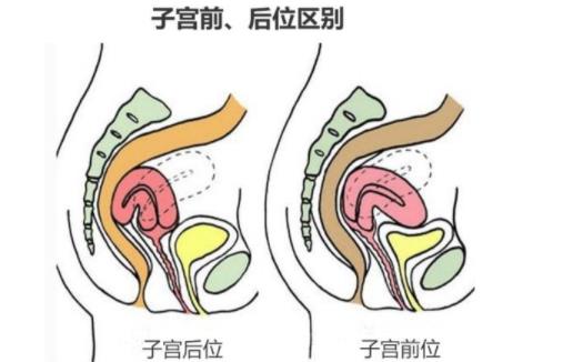 子宮前位容易懷孕嗎 子宮前位和子宮后位的區(qū)別