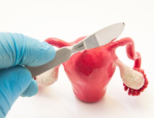 人流跟引產是一回事嗎?引產是怎么回事?