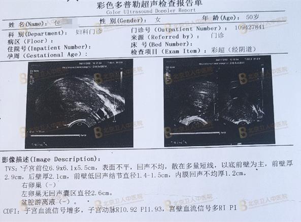 子宮腺肌癥能保住子宮嗎?50歲包大姐終于打贏這場(chǎng)長(zhǎng)達(dá)20年的“子宮保衛(wèi)戰(zhàn)”!