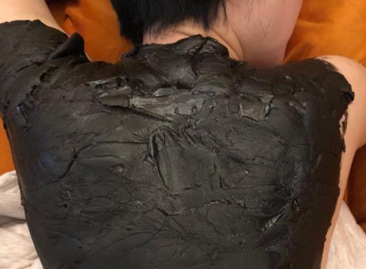 泥灸對婦科炎癥有用嗎?泥灸能把體內寒濕全部排出來嗎?