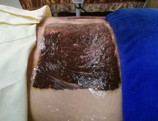 泥灸是敷背還是敷肚子最好?泥灸敷肚子減肥多久見效?