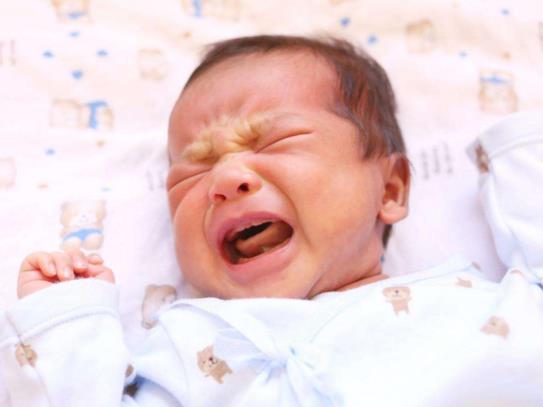 新生兒黃疸怎么看是生理性還是病理性?新生兒黃疸怎么辦