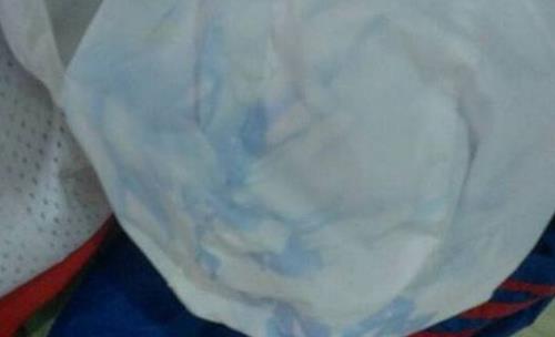 衣服染色如何去掉 衣服染色去除小竅門