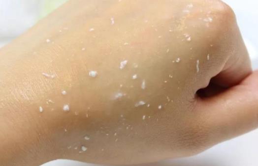 不去角質(zhì)是不是用的護(hù)膚品都不會(huì)吸收 去角質(zhì)素多久用一次比較好