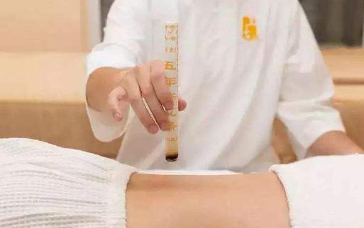 三九灸不做預灸可以嗎 冬天為什么要做三九灸