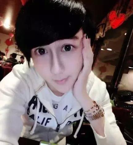 “蛇精男”劉梓晨多次整容整成蛇精臉