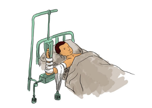 骨折病人吃什么好？骨折愈合的時(shí)間