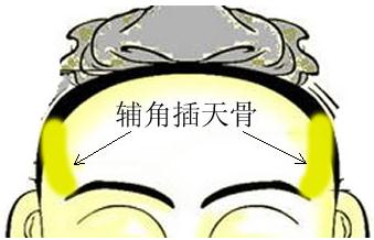 骨相圖解:輔角插天骨