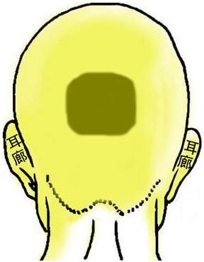 骨相圖解:四方金印骨