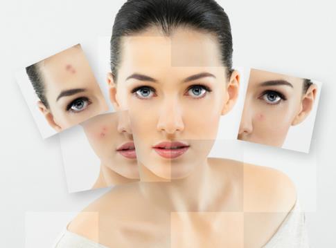 美白祛斑誤區:愛美女性須知的美白祛斑四個誤區