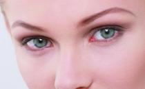 結(jié)膜炎會(huì)傳染嗎？ 科學(xué)的認(rèn)識(shí)結(jié)膜炎