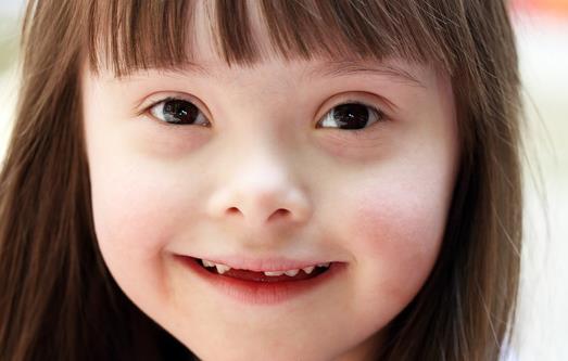 你了解唐氏癥嗎? 唐氏癥有哪些癥狀?