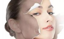 怎么才能祛斑？為什么會長斑？