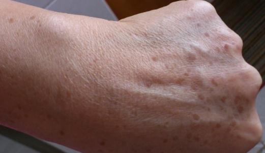 充足睡眠預防老年斑 吃什么可以祛除老年斑