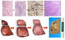 如何預防脂肪肝？注意哪些習慣？