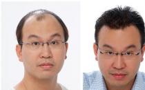 小妙方巧調理 秋季掉發不擔憂