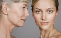 電波拉皮去除魚(yú)尾紋的效果