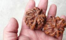 西醫大夫 自創核桃操治好早搏