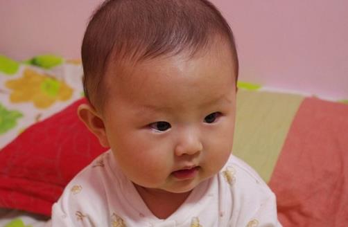 冬季養生 寶寶嘴唇干裂怎么辦