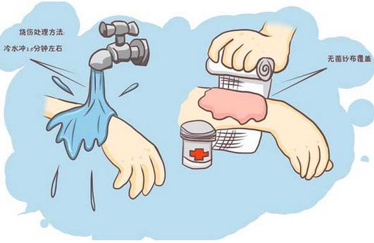 如何處理燒燙傷后起的水泡?