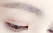 激光洗眉特點多 你心動了嗎？