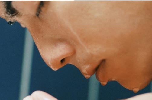 男性如何護理好冬季干燥的皮膚