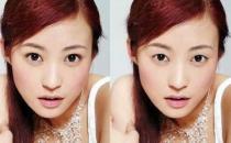 雙眼皮手術留疤了要怎么辦