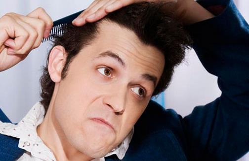 中年男性脫發怎么辦?
