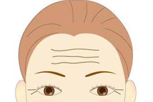 美容達(dá)人教你怎樣防治抬頭紋