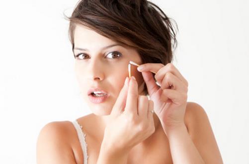 激光祛痘 要認清痘痘類型