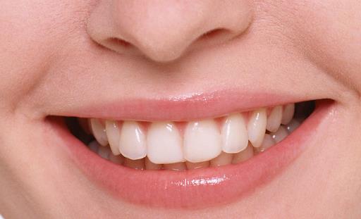 不同季節對待唇部問題要不同對待