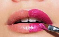 玻尿酸豐唇 展現女性魅力